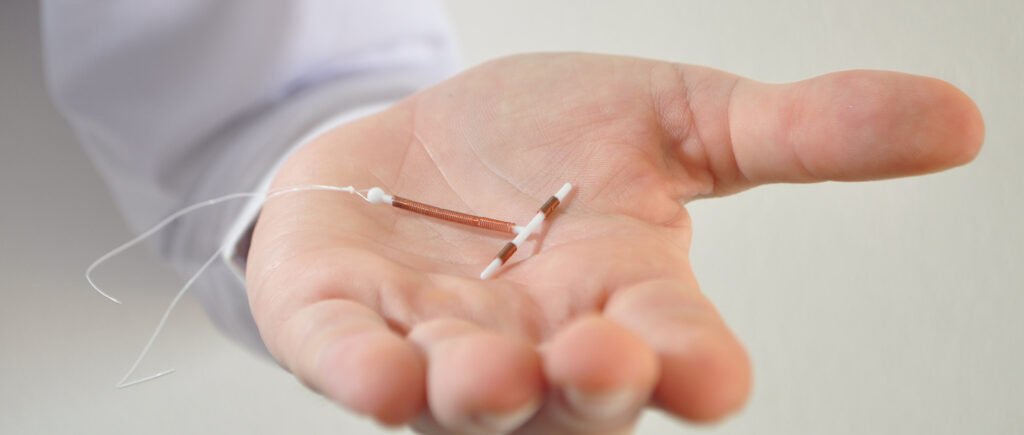 DIU y Otros Métodos Anticonceptivos.