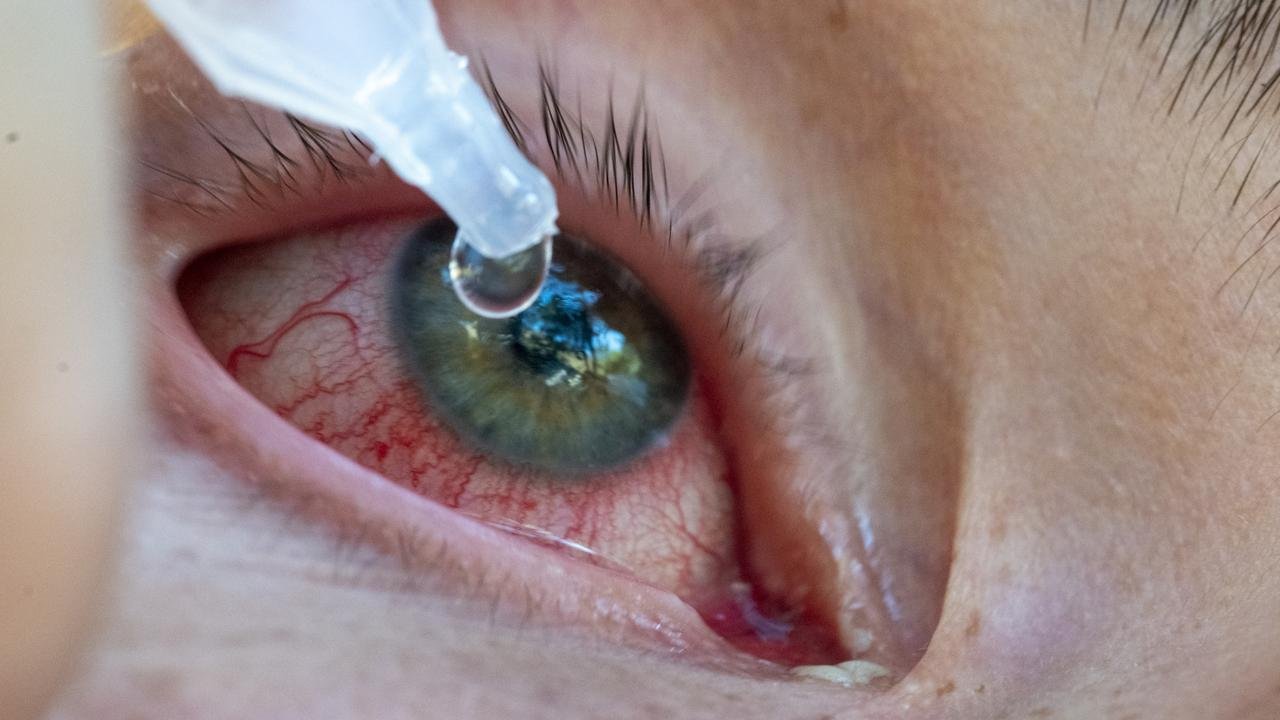 Arcturus la nueva variante de Covid.